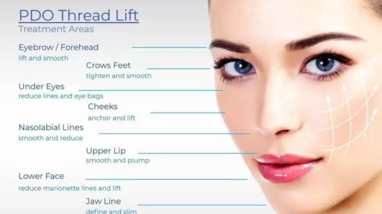 Facial Rejuvenation With PDO Threads Skin Lift